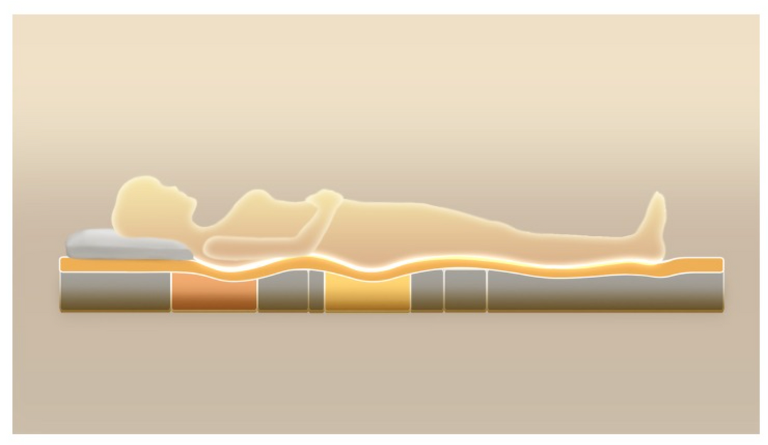  While this mattress offers fewer customizable features, it still significantly reduces excessive pressure on the over-pressured areas 